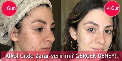 Yağ emici mendil Kullanıcıları ve Zararları 3