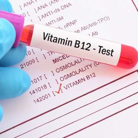 B12 Vitamin 2